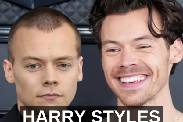 Harry Styles Kel mi? İşte Harry Styles’ın Saçlarıyla İlgili Bildiklerimiz