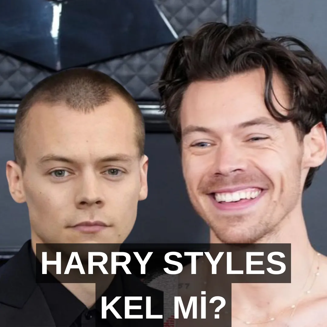 harry styles kel mi