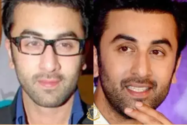 Gerüchte Über Eine Haartransplantation Bei Ranbir Kapoor: Fue vs. Dhi, Transplantate, Genesung