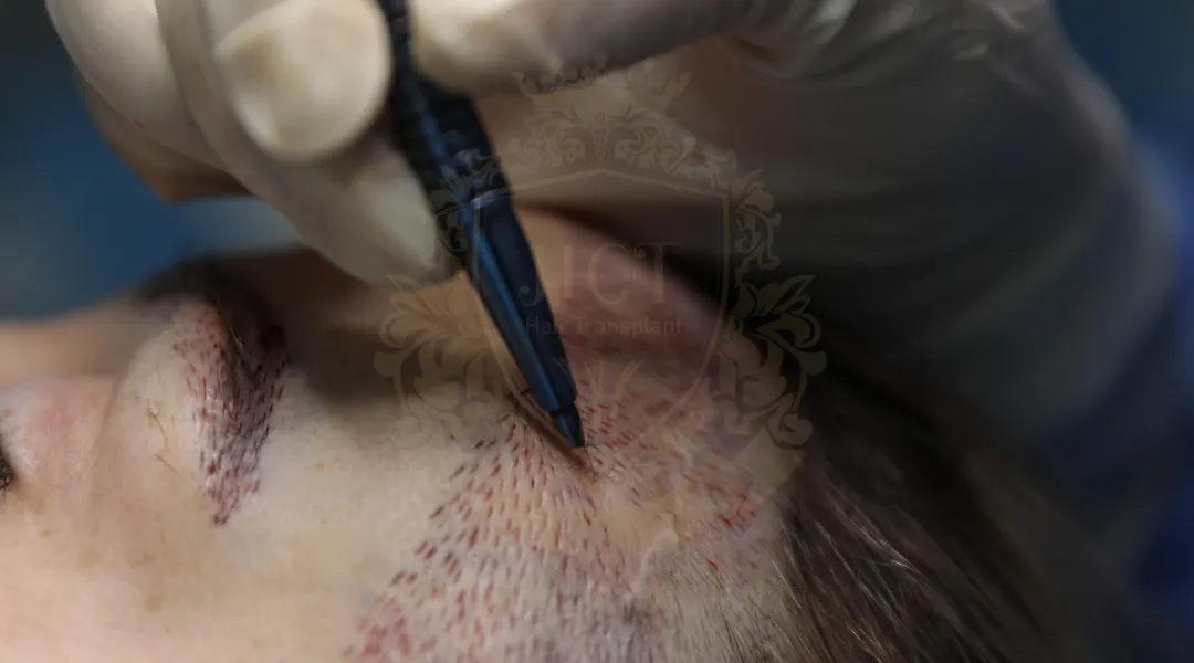 sapphire fue channel opening process