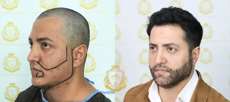 Por Que Os Pacientes Transgêneros Se Beneficiam De Um Plano Personalizado