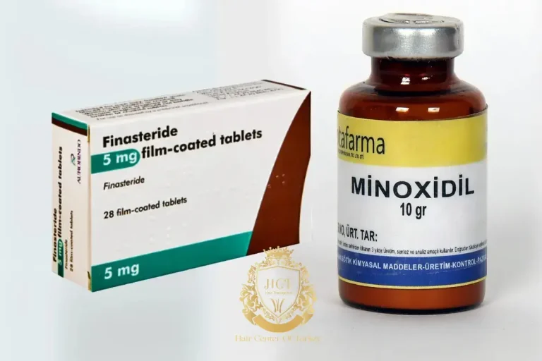 Effets secondaires du finastéride et du minoxidil