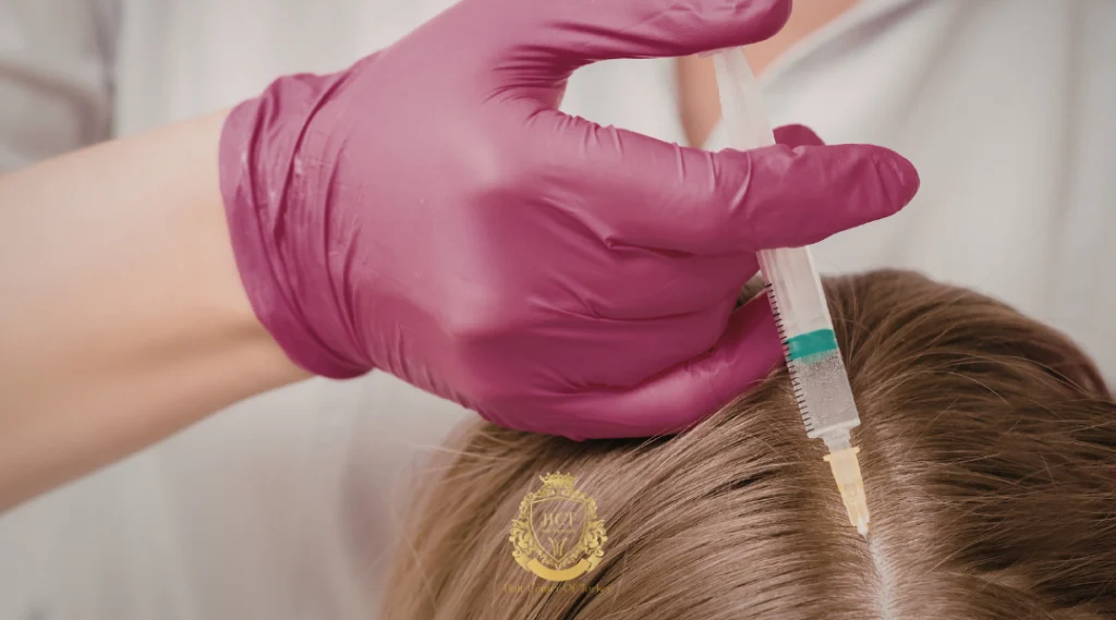 Saç Dökülmesine Karşı Ekzozom Tedavisi