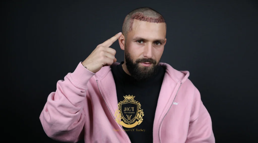 İstanbul Yenibosna'daki Saç Ekimi Klinikleri