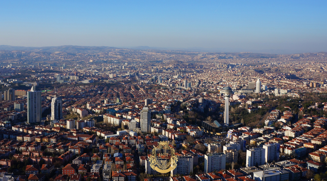 Hair Transplant in Ankara