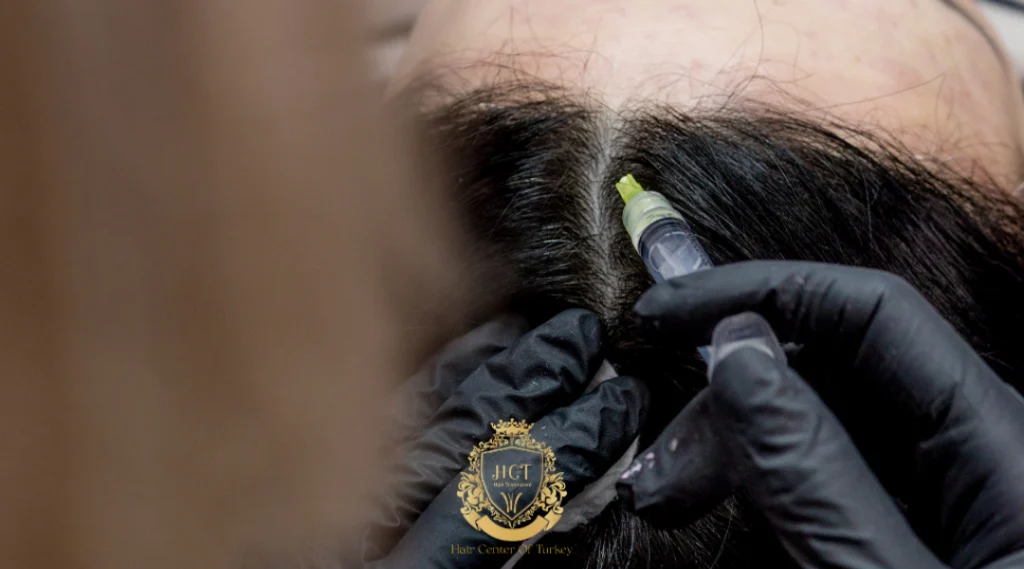 Tratamiento de mesoterapia en Estambul: cómo funciona, beneficios y resultados