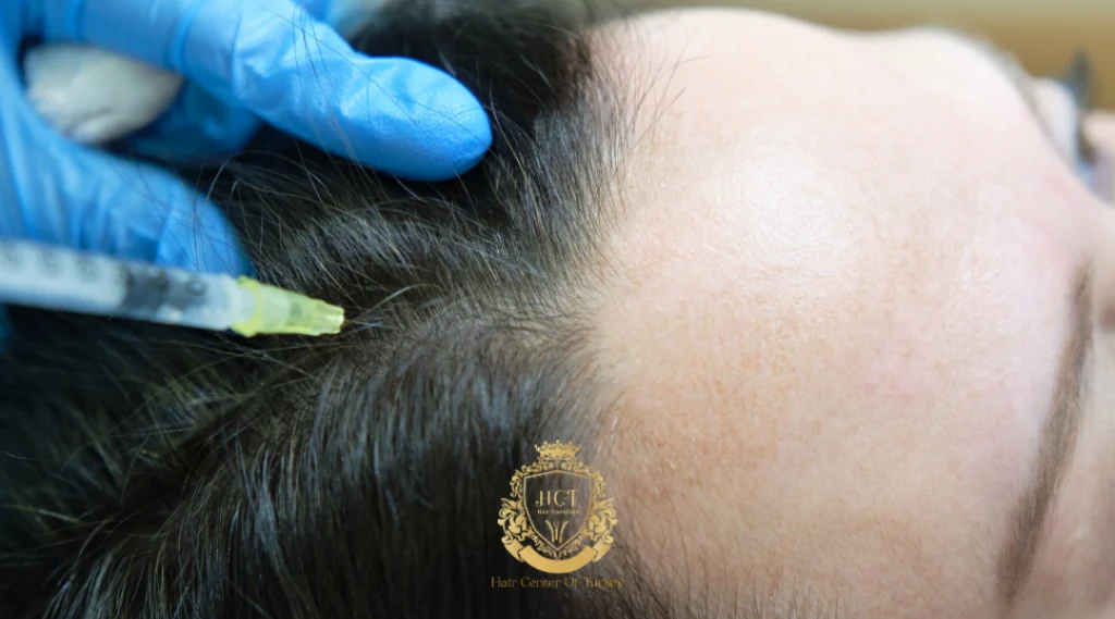 Tratamiento de mesoterapia en Estambul: cómo funciona, beneficios y resultados