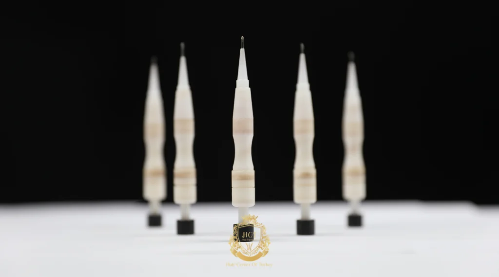 Greffe de cheveux sans rasage en Alabama 3 Greffe de cheveux sans rasage en Alabama