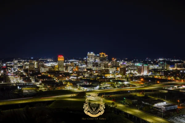 What Are the Hair Transplant Methods in Birmingham?