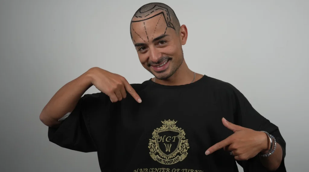 Hair Transplant Cost in İzmir