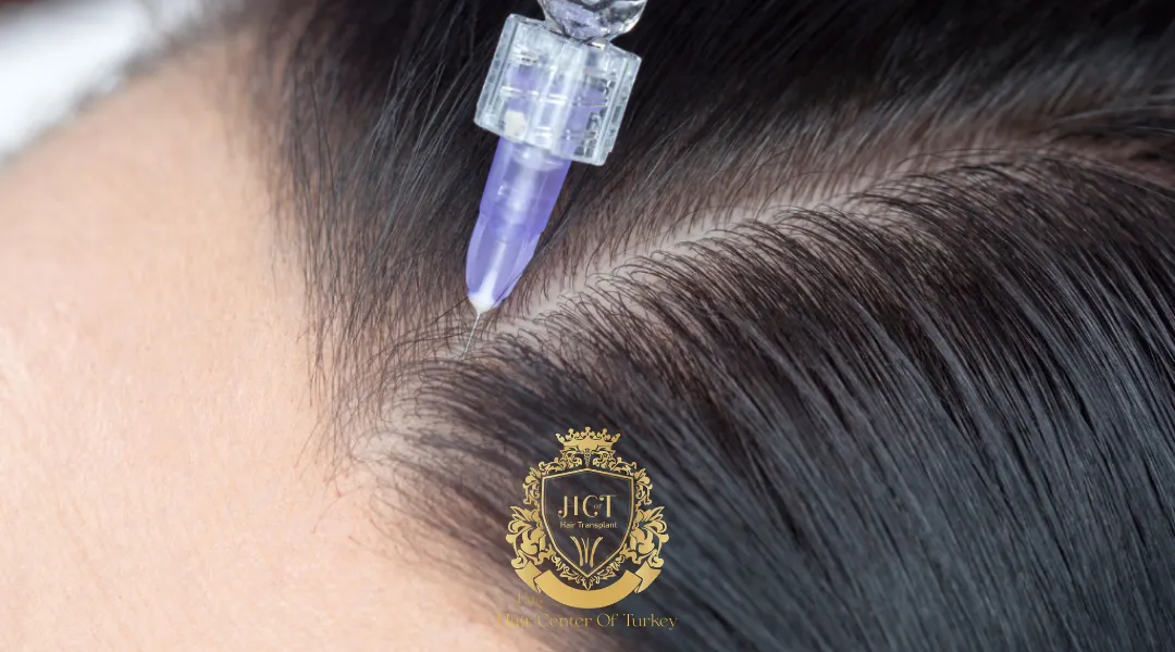 Are There Risks of Exosome Hair Therapy Honest Look