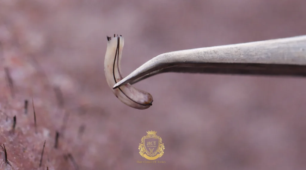 Coût moyen en fonction du nombre de greffons