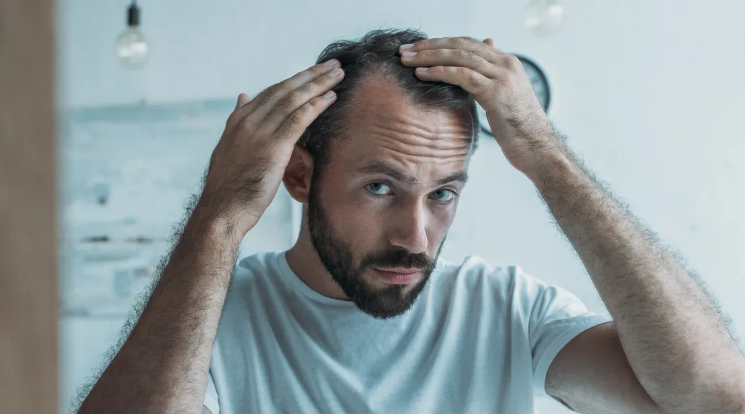 Can an Irregular Sleep Schedule Cause Hair Loss