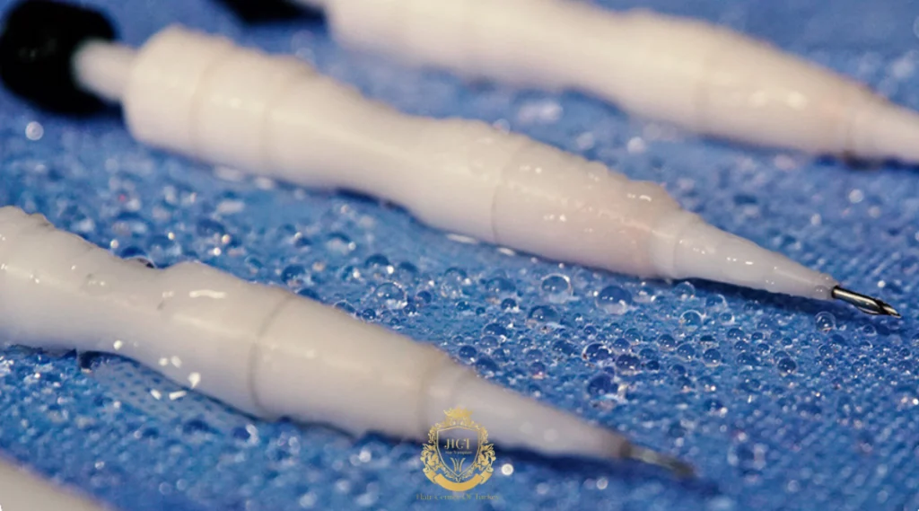 What Are the Hair Transplant Methods in Birmingham?