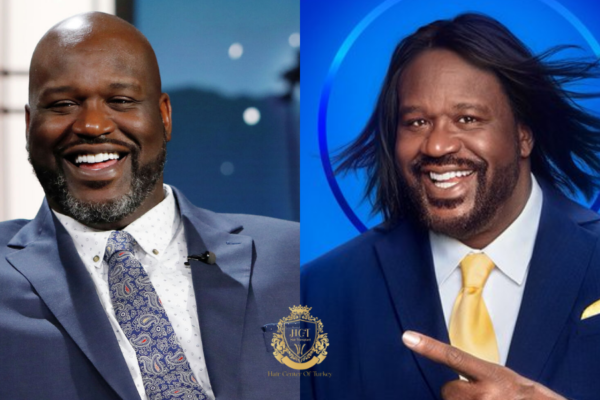 Shaquille O’Neal è venuto in Turchia per un trapianto di capelli?