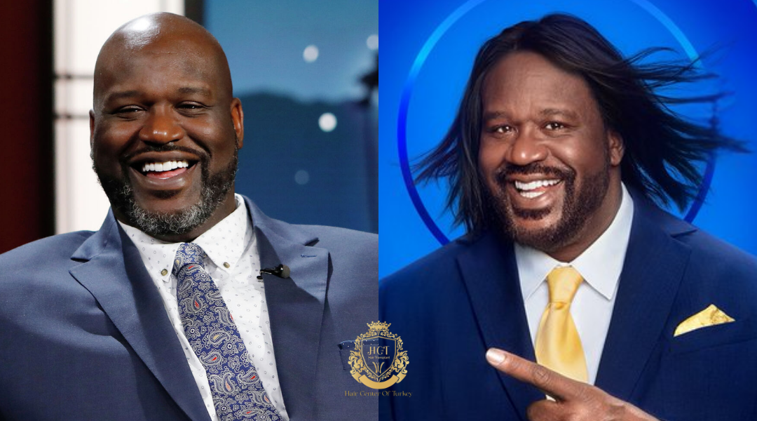 Será que Shaquille O'Neal veio à Turquia para fazer um transplante capilar?