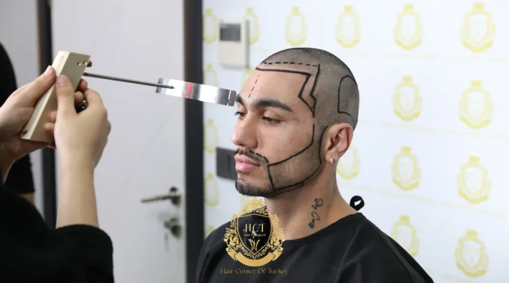 Preise für Haartransplantationen in Sisli