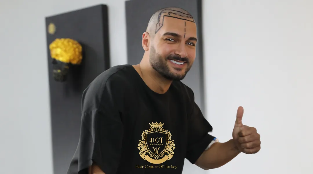 How to Know If You Are a Good Candidate for Hair Transplant