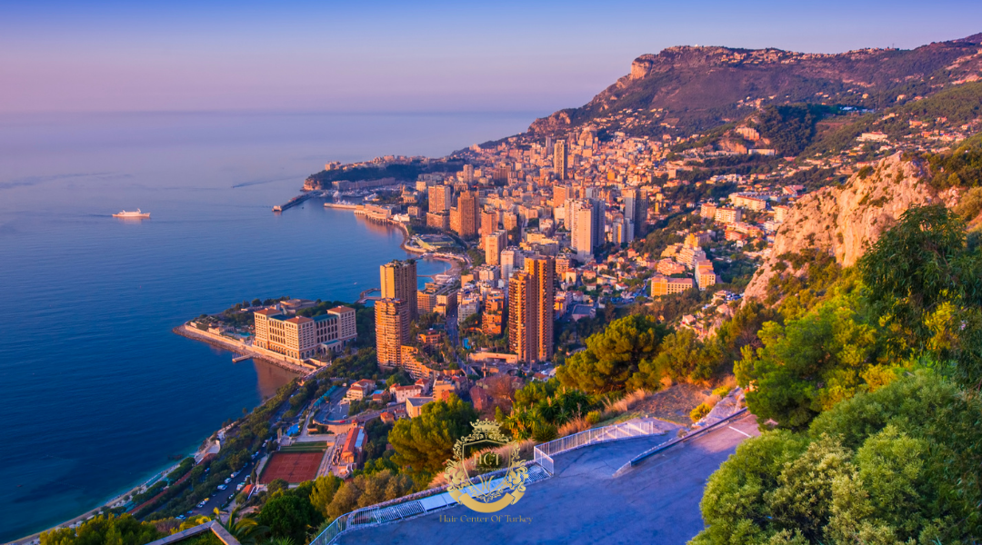 Tarifs des greffes de cheveux à Monaco en 2026