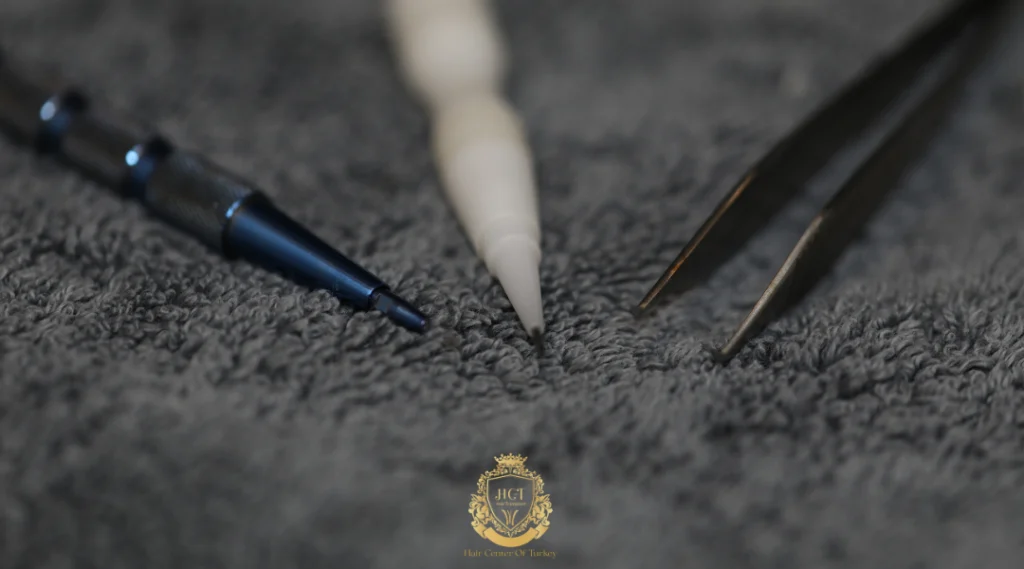 Hair Transplant Cost in İzmir