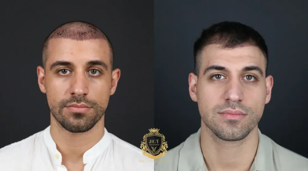 What You Can Expect in the First Few Months