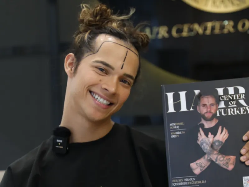 Wat kost een haartransplantatie in Turkije?