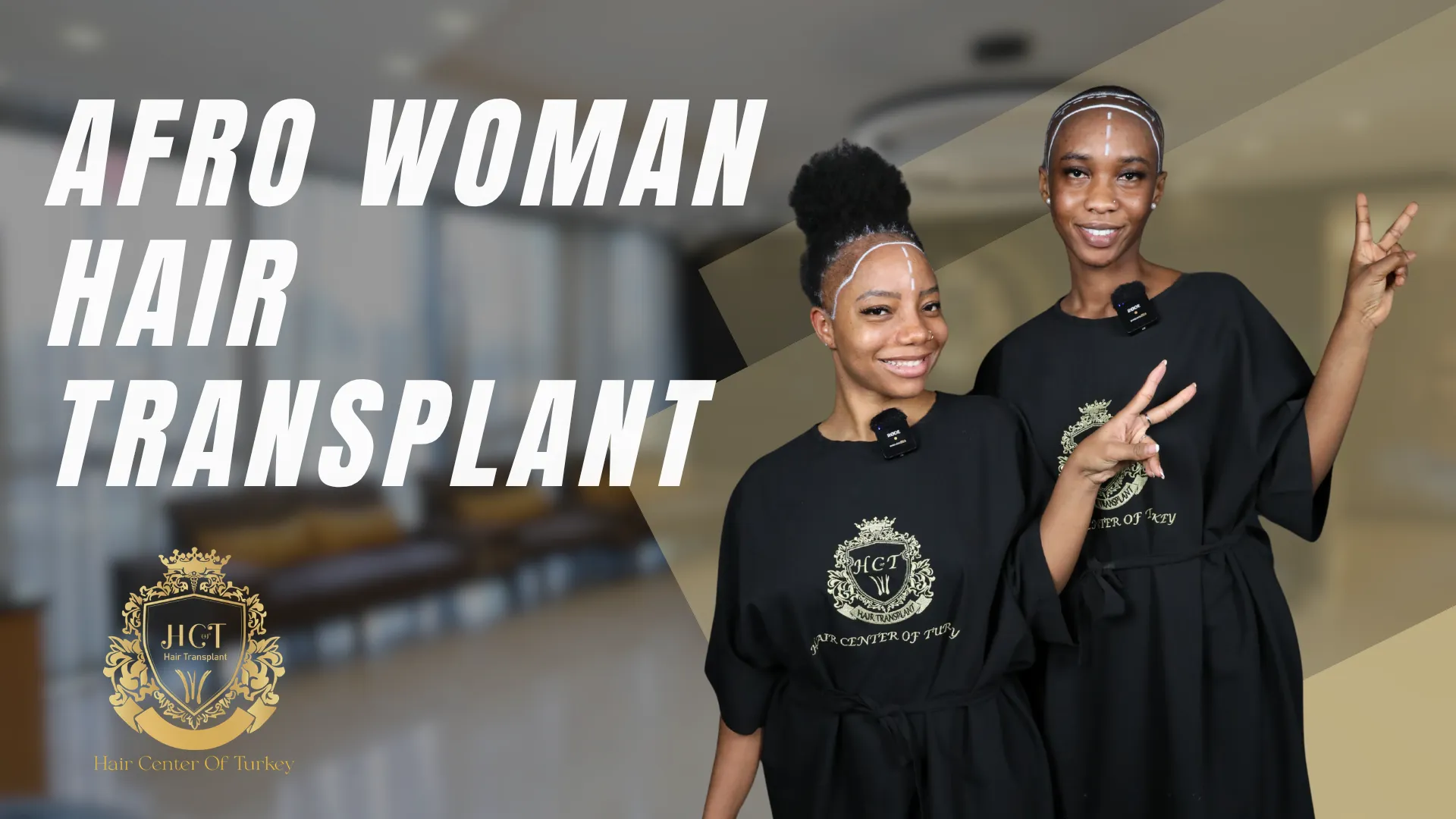 Recensioni sul trapianto di capelli per donne afro