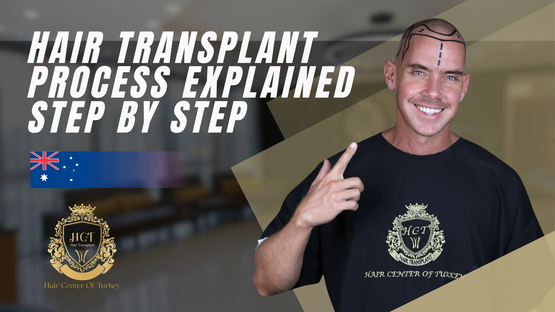 Die Haartransplantationsreise von Dr. Adam Hotchkiss