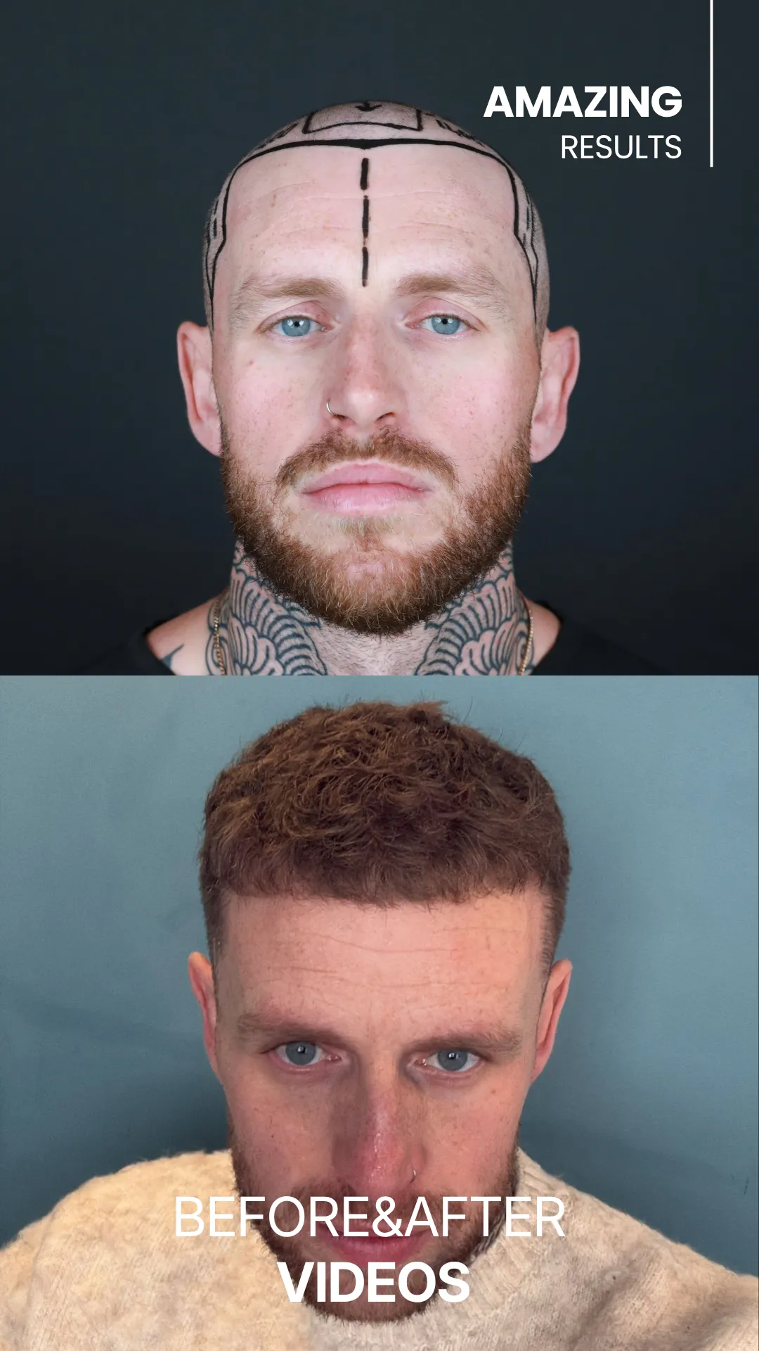 jordan richard gilles barber before and after