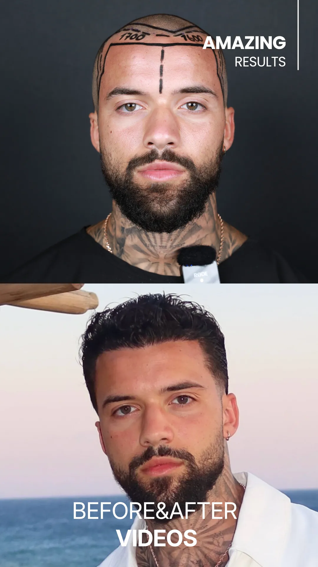 marcus before and after