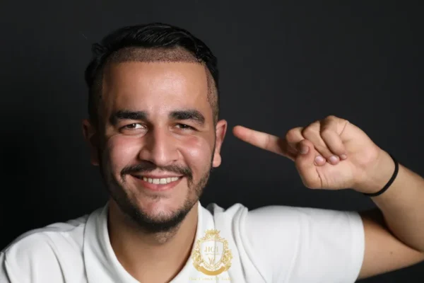 Is a Partially Shaven Hair Transplant Right for You?
